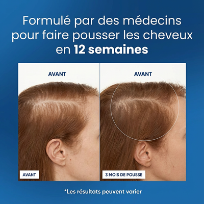 Roll-on de croissance capillaire