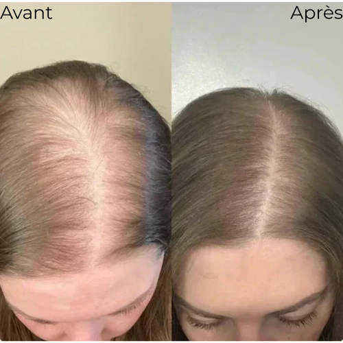 Le Revitalisant Moléculaire Mulys