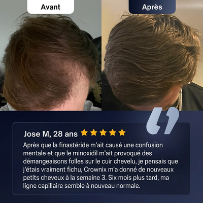 Roll-on de croissance capillaire