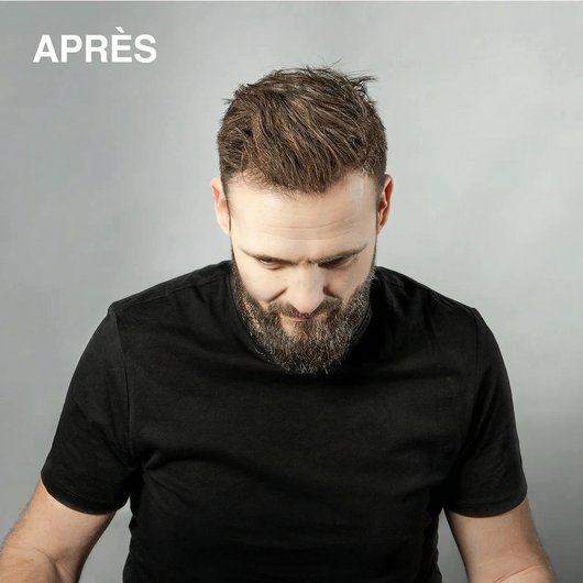 Spray Densifiant Instantané - Mulys