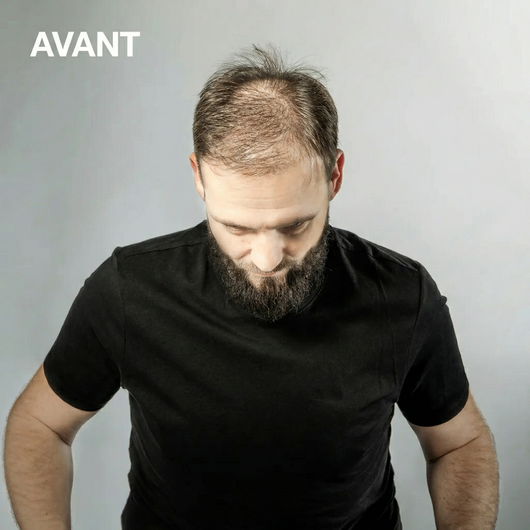 Spray Densifiant Instantané - Mulys