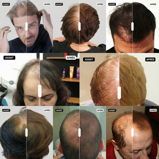 Spray Densifiant Instantané - Mulys